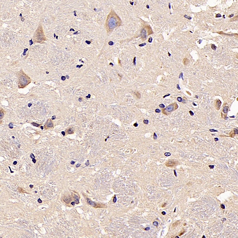 Immunohistochemistry analysis of parafffin-embedded rat brain  using LDHA Polyclonal Antibody at dilution of 1:300.