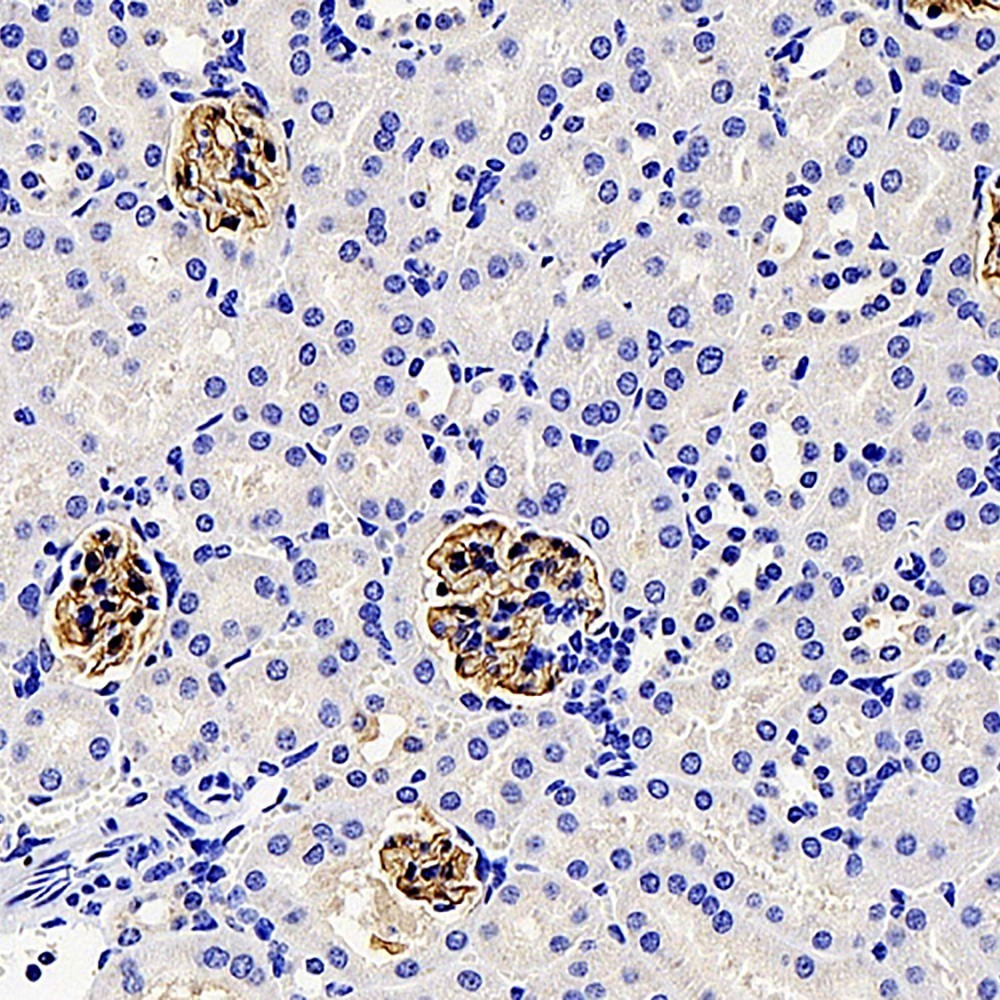 Immunohistochemistry analysis of paraffin-embedded mouse kidney  using NPHS1 Polyclonal Antibody at dilution of 1:1000.