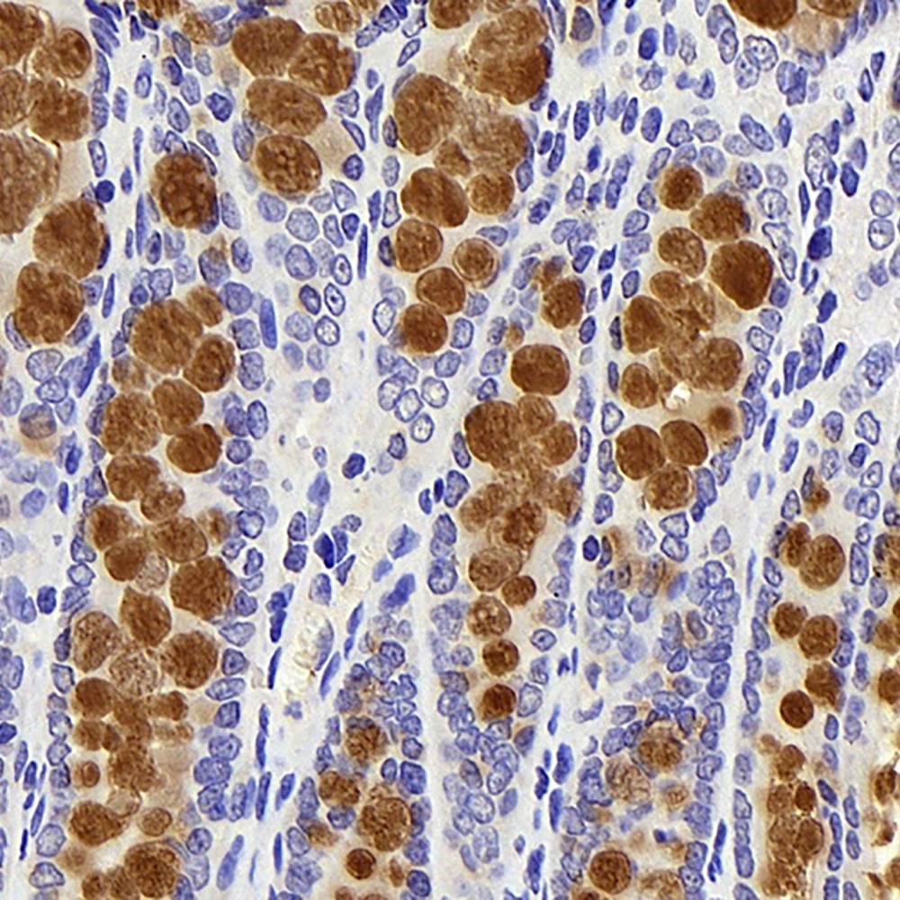 Immunohistochemistry analysis of paraffin-embedded rat colon  using MUC2 Polyclonal Antibody at dilution of 1:600.