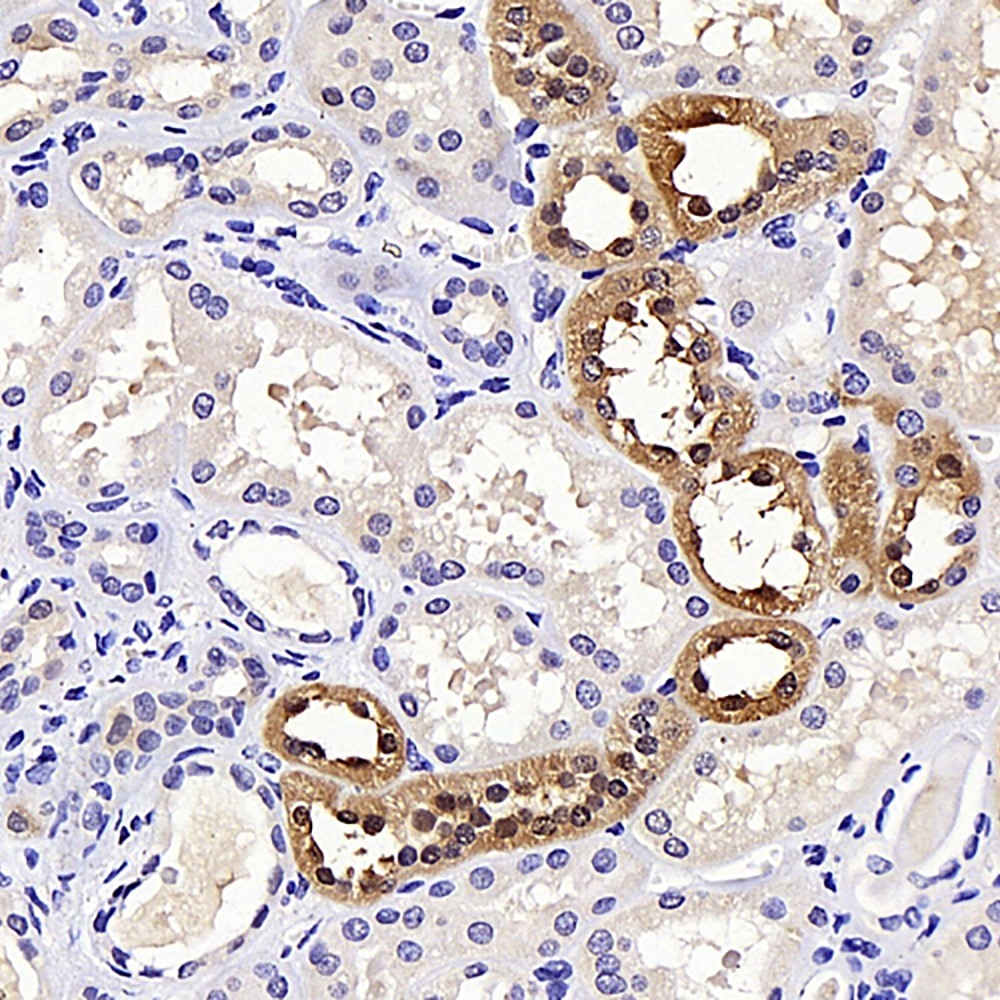 Immunohistochemistry analysis of parafffin-embedded human kidney  using NOX4 Polyclonal Antibody at dilution of 1:400.