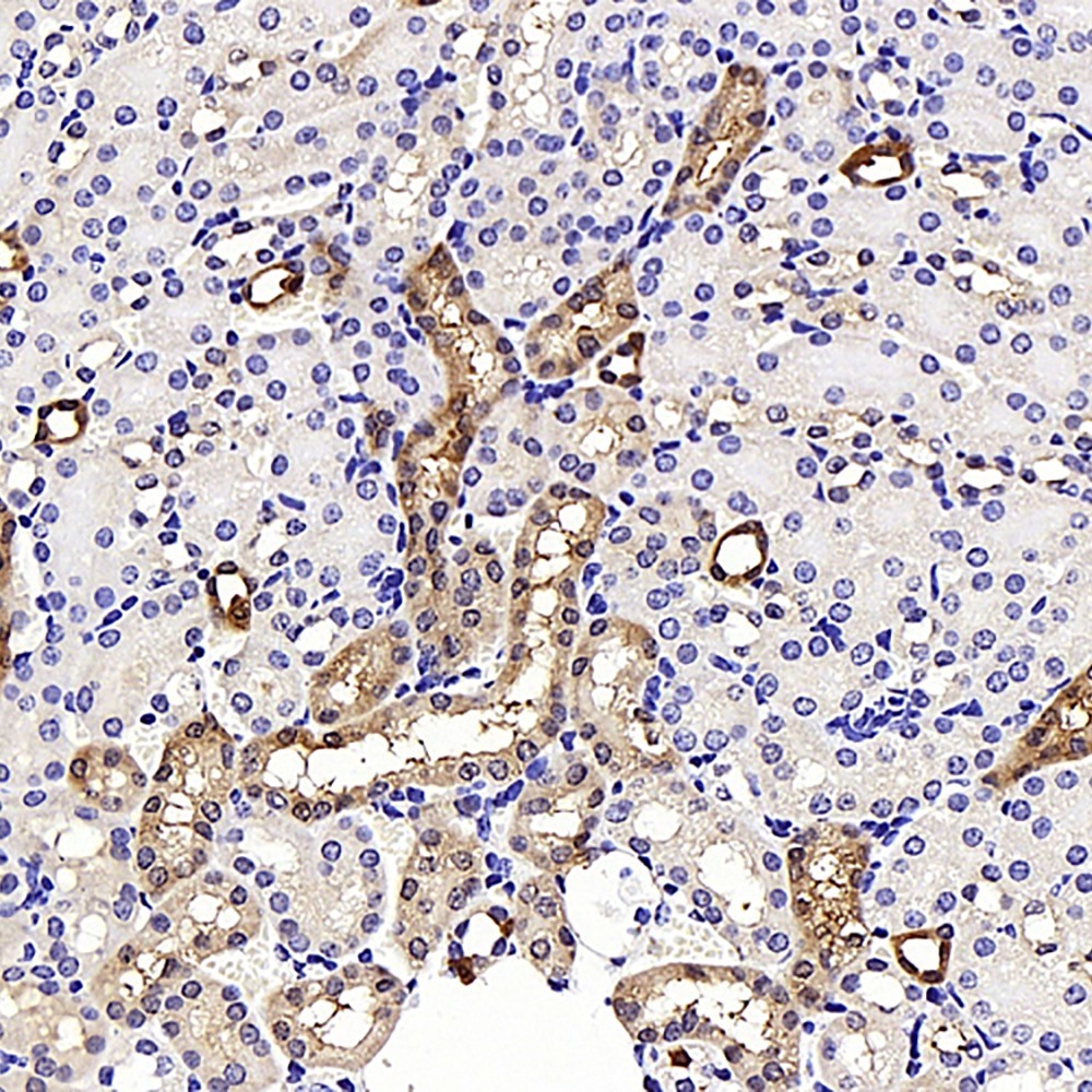 Immunohistochemistry analysis of parafffin-embedded mouse kidney  using NOX4 Polyclonal Antibody at dilution of 1:400.