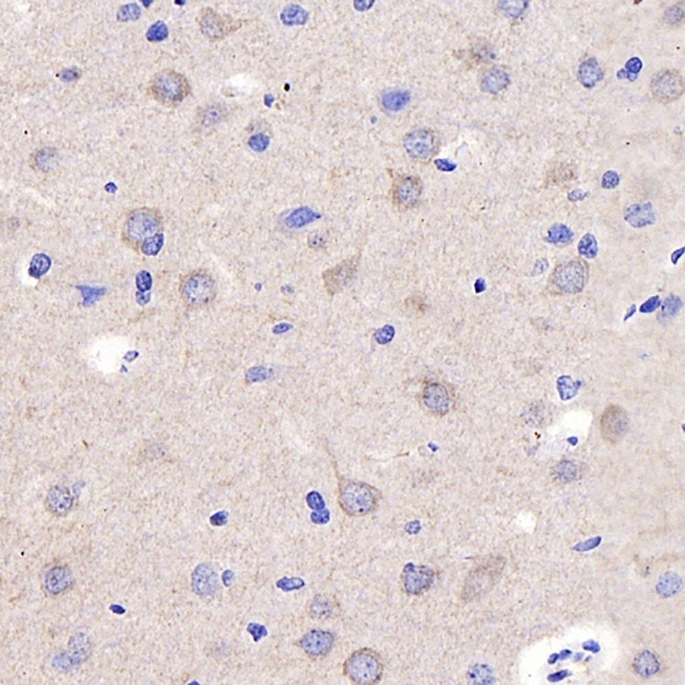 Immunohistochemistry analysis of parafffin-embedded rat brain  using P2RX3 Polyclonal Antibody at dilution of 1:400.