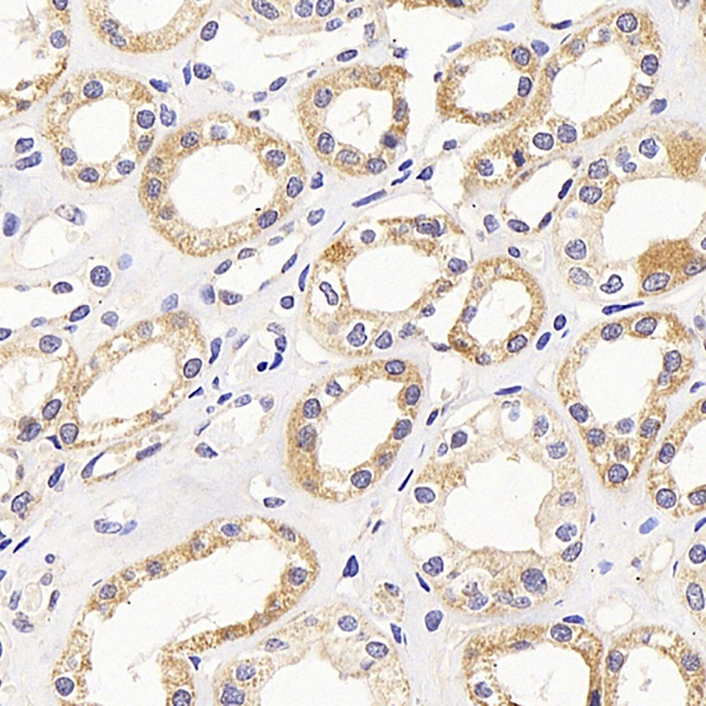 Immunohistochemistry analysis of paraffin-embedded human kidney  using PMVK Polyclonal Antibody at dilution of 1:1000.