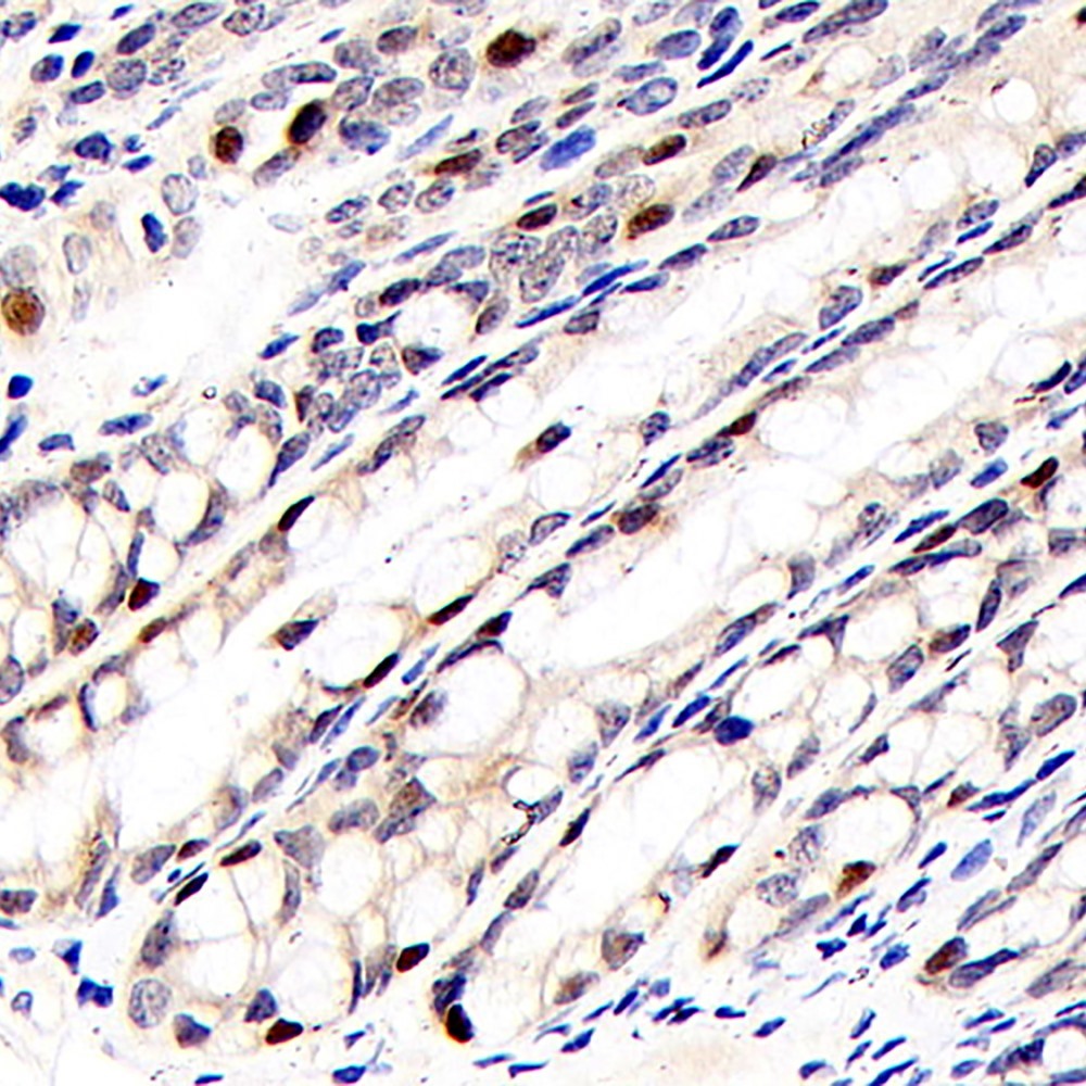 Immunohistochemistry analysis of paraffin-embedded mouse colon  using RELB Polyclonal Antibody at dilution of 1:400.