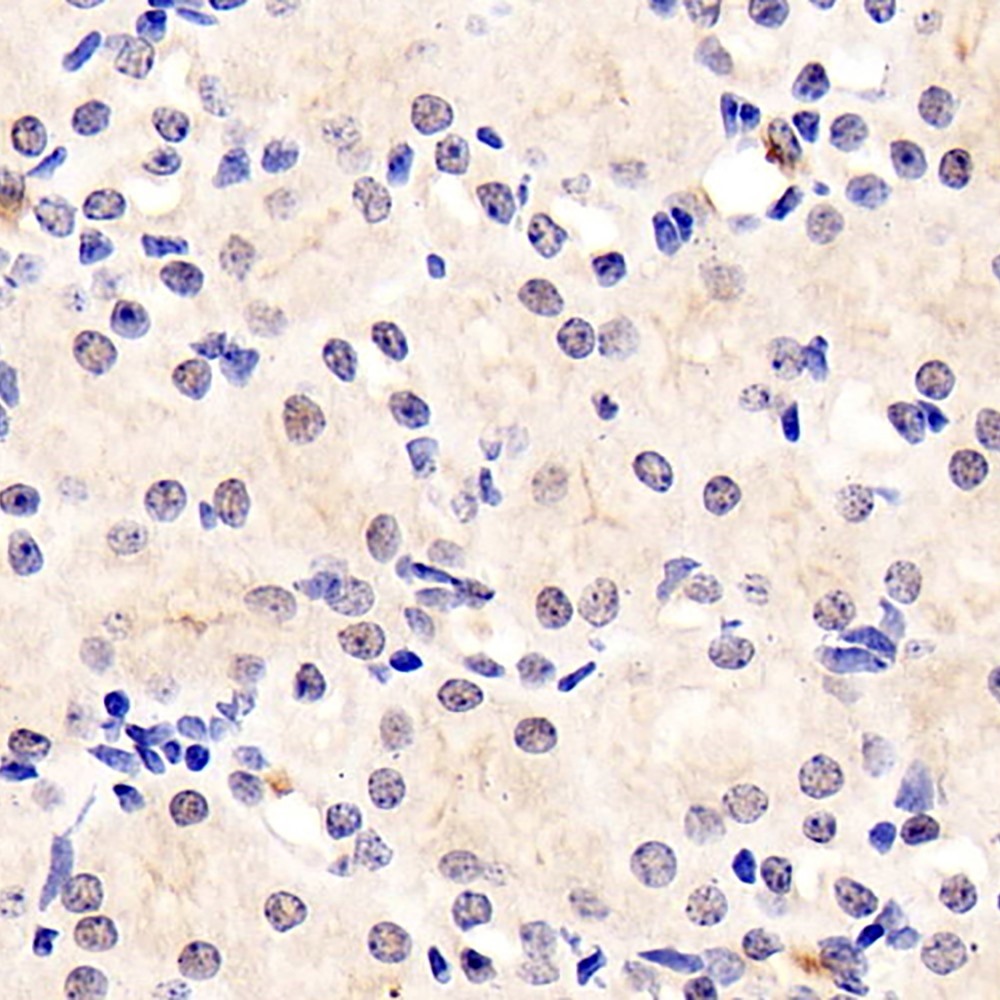 Immunohistochemistry analysis of paraffin-embedded mouse kidney  using RELB Polyclonal Antibody at dilution of 1:400.