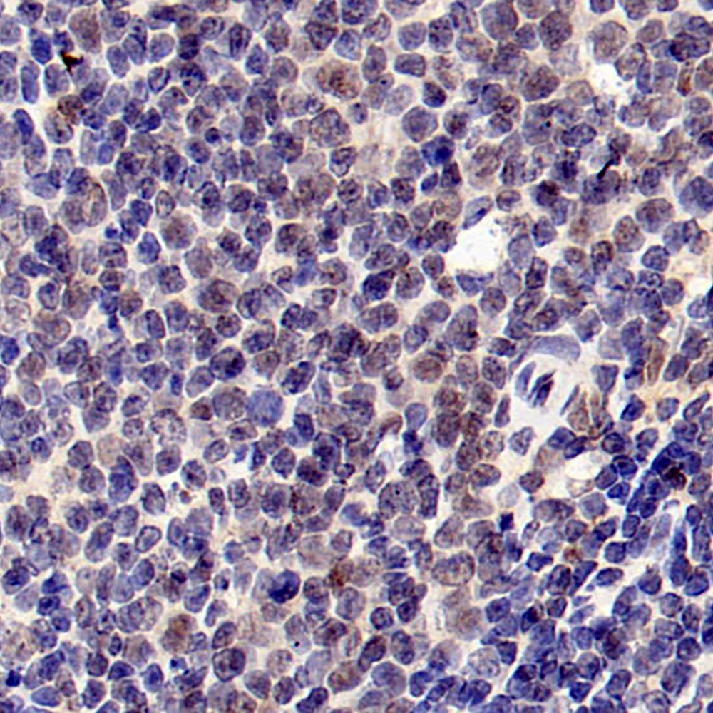 Immunohistochemistry analysis of paraffin-embedded rat spleen  using RELB Polyclonal Antibody at dilution of 1:400.