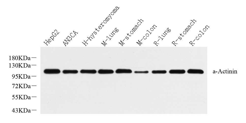 Western Blot analysis of various samples using ACTN1 Polyclonal Antibody at dilution of 1:2000.