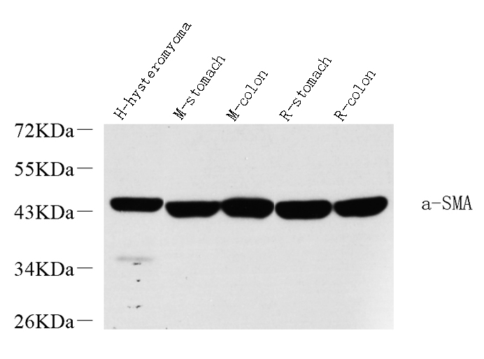 Western Blot analysis of various samples using ACTA2 Polyclonal Antibody at dilution of 1:2000.