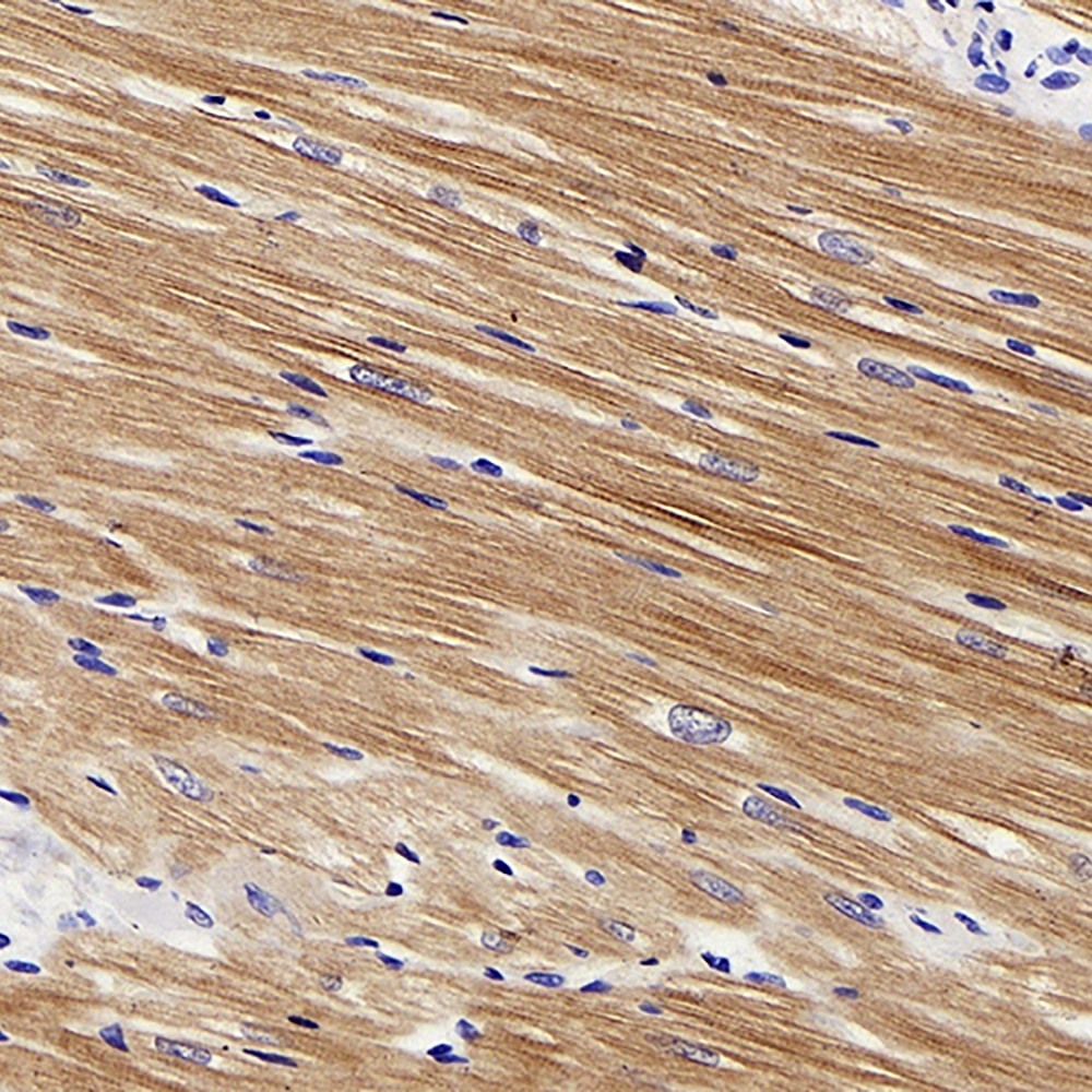 Immunohistochemistry analysis of paraffin-embedded rat heart  using TNNT2 Polyclonal Antibody at dilution of 1:200.