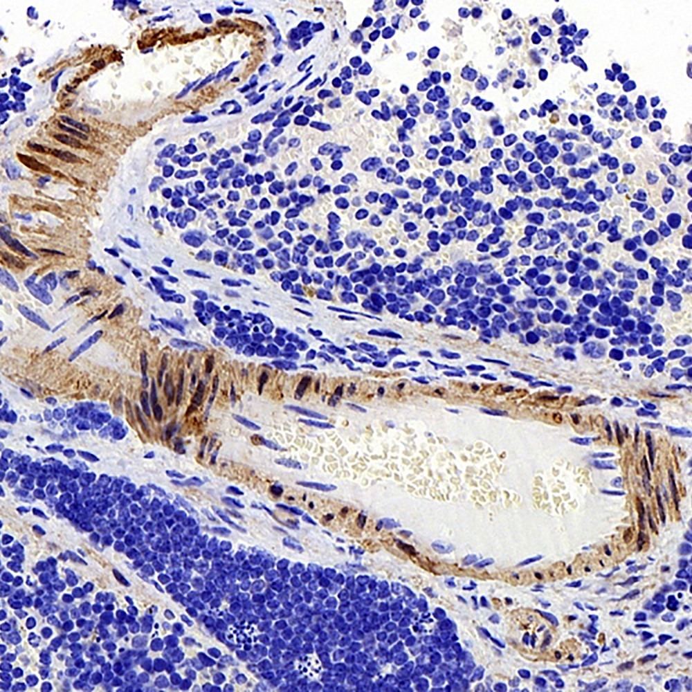 Immunohistochemistry analysis of paraffin-embedded mouse spleen  using TAGLN Polyclonal Antibody at dilution of 1:400.