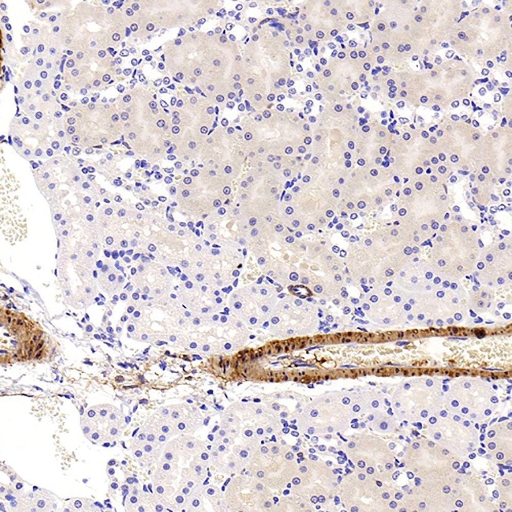 Immunohistochemistry analysis of paraffin-embedded Rat kidney  using TAGLN Polyclonal Antibody at dilution of 1:400.