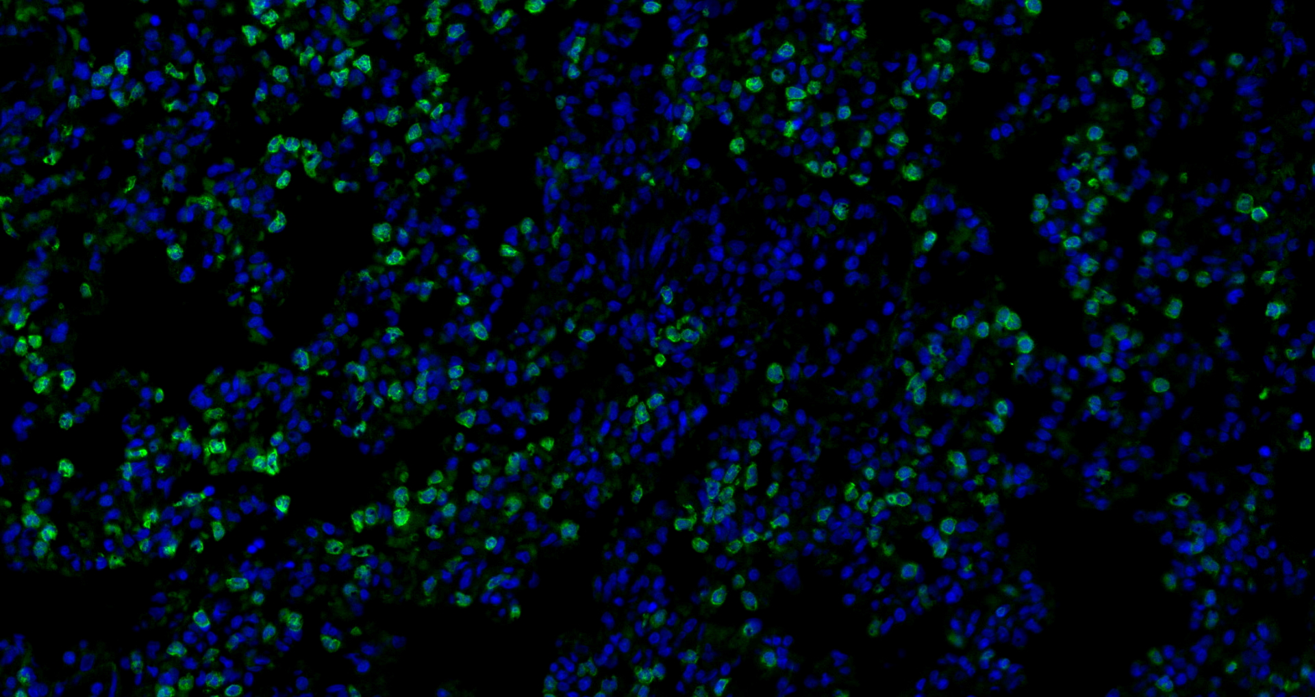 Immunofluorescence analysis of paraffin-embedded rat Inflammatory lung  using IL10 Polyclonal Antibody at dilution of 1:300.