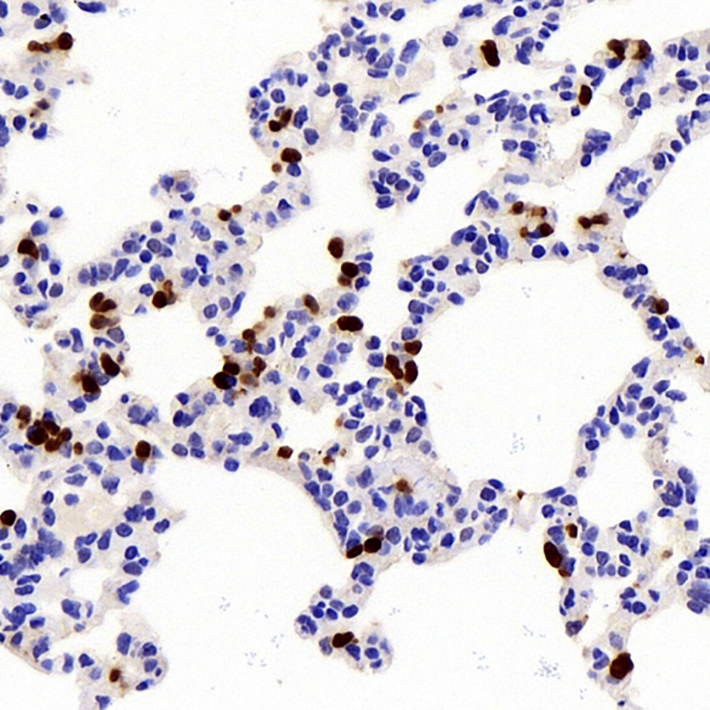 Immunohistochemistry analysis of paraffin-embedded mouse lungs using IL10 Polyclonal Antibody at dilution of 1:300.