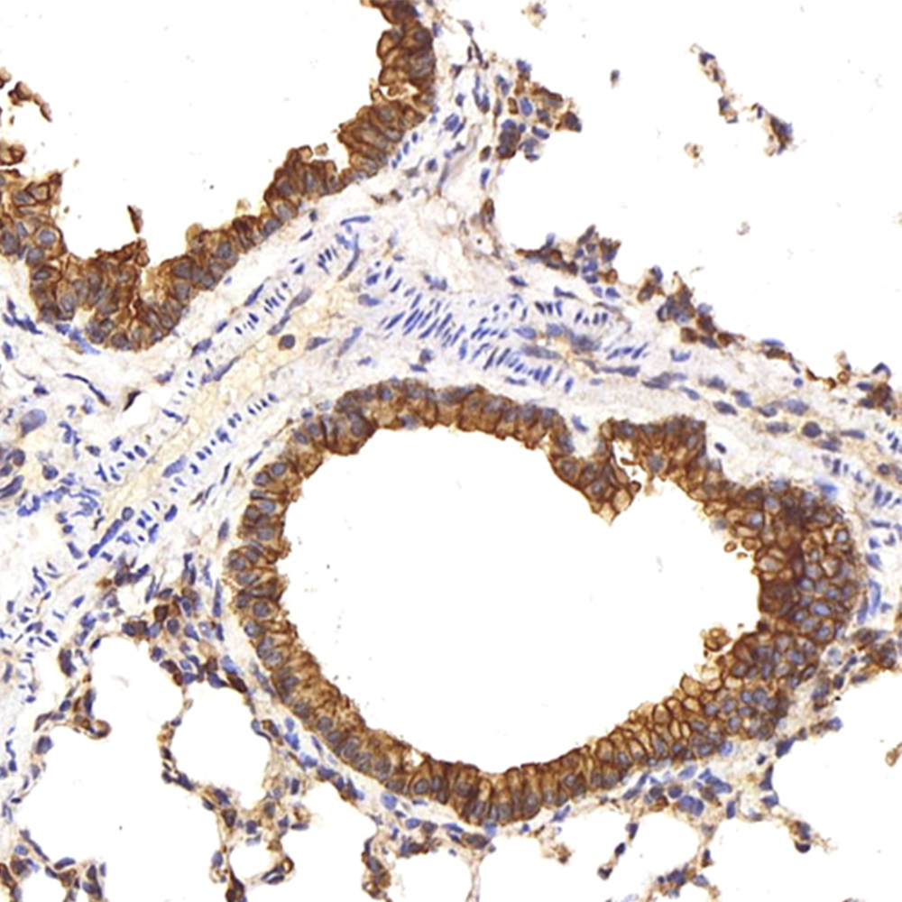 Immunohistochemistry analysis of paraffin-embedded mouse lung  using CK-8 Polyclonal Antibody at dilution of 1:200.