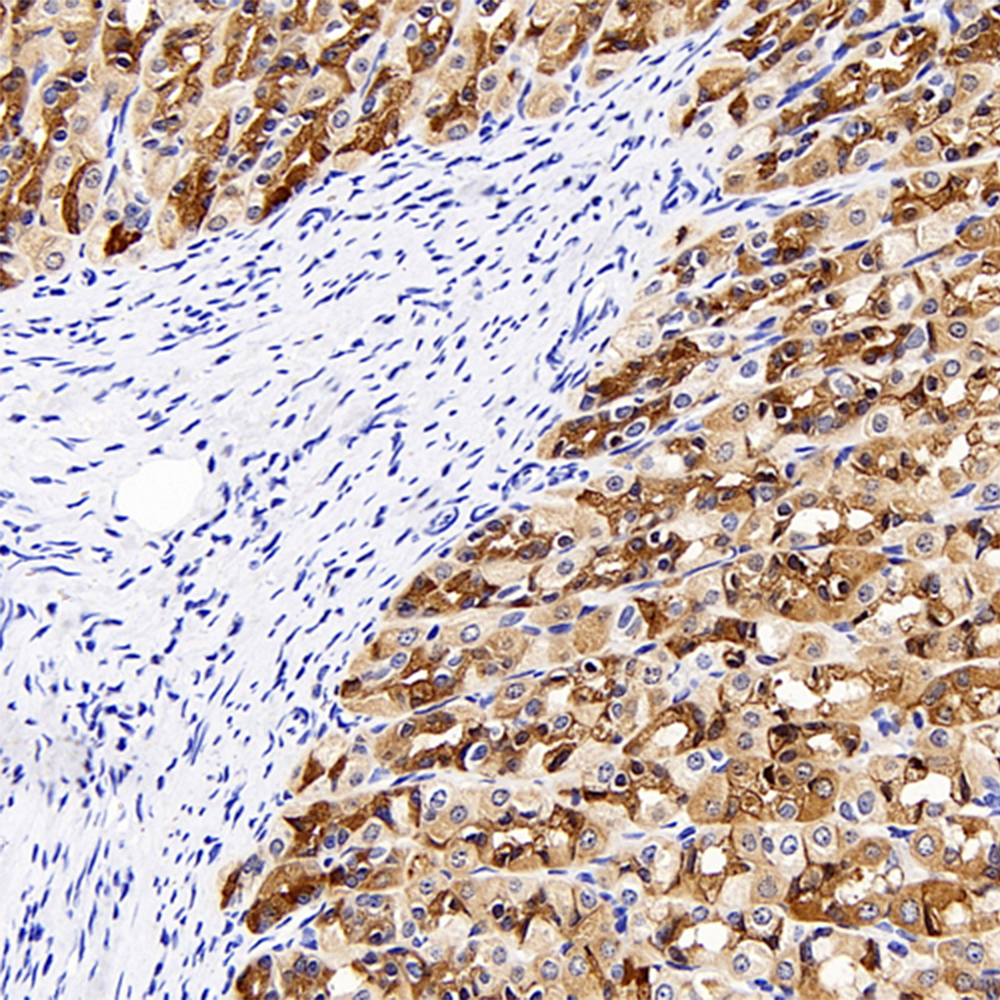 Immunohistochemistry analysis of paraffin-embedded rat stomach  using CK-8 Polyclonal Antibody at dilution of 1:300.