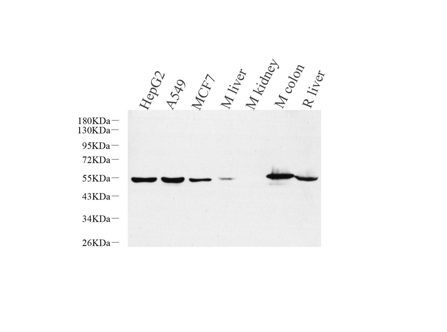 Western Blot analysis of various samples using CK-8 Polyclonal Antibody at dilution of 1:1000.