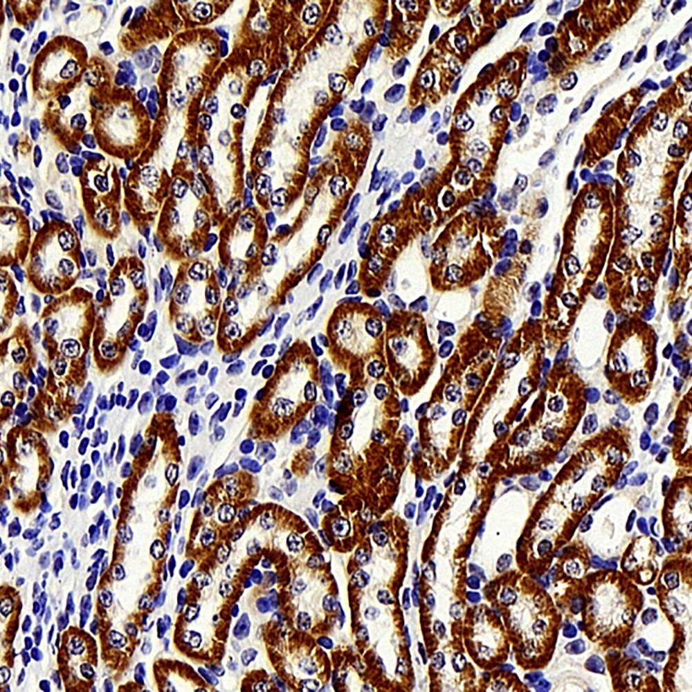 Immunohistochemistry analysis of paraffin-embedded mouse kidney  using BRAF Polyclonal Antibody at dilution of 1:400.