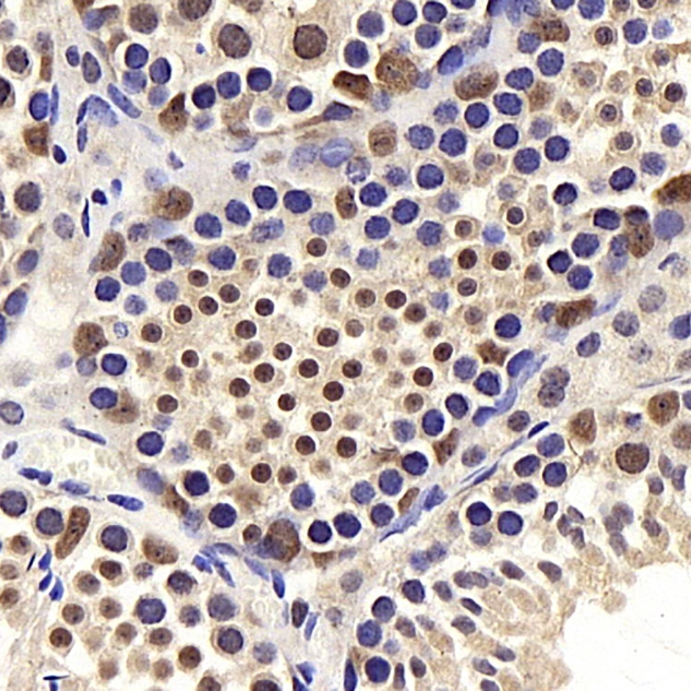 Immunohistochemistry analysis of paraffin-embedded mouse testis  using BRAF Polyclonal Antibody at dilution of 1:400.