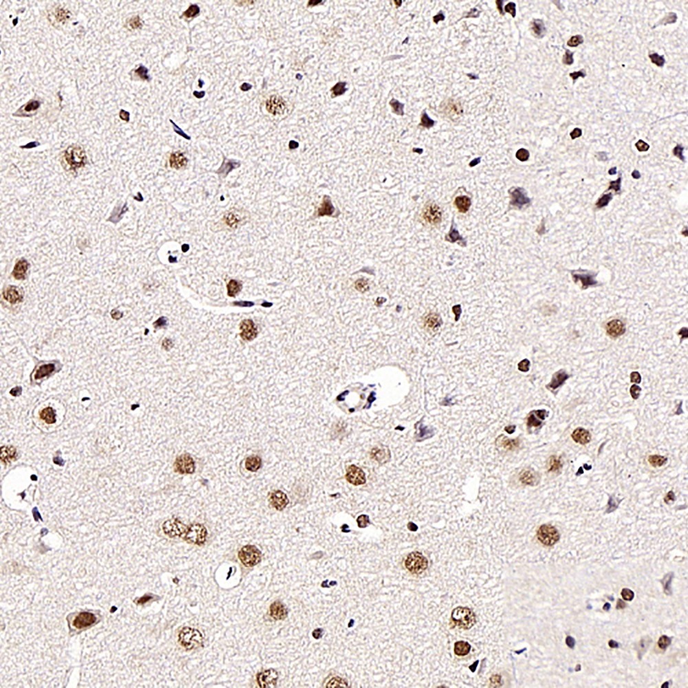 Immunohistochemistry analysis of paraffin-embedded rat brain  using BRAF Polyclonal Antibody at dilution of 1:300.