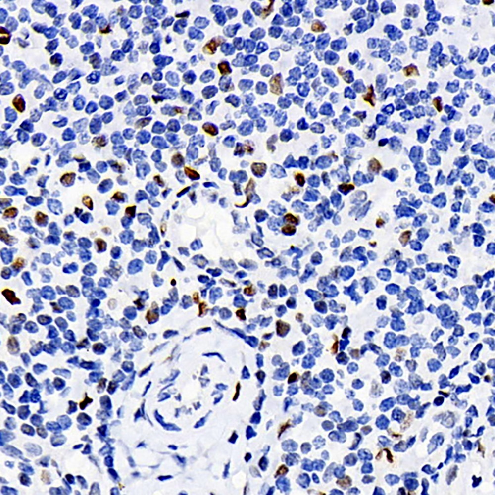Immunohistochemistry analysis of paraffin-embedded human tonsil  using ERK 2 Polyclonal Antibody at dilution of 1:100.