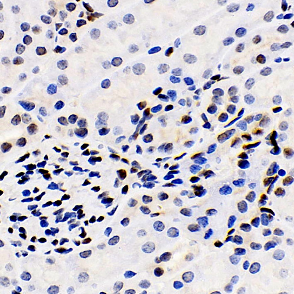 Immunohistochemistry analysis of paraffin-embedded mouse kidney  using ERK 2 Polyclonal Antibody at dilution of 1:100.