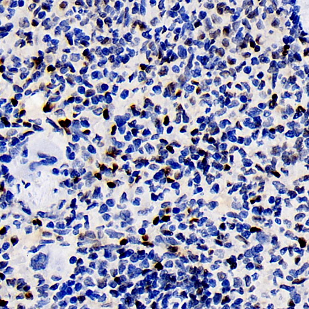 Immunohistochemistry analysis of paraffin-embedded rat spleen  using ERK 2 Polyclonal Antibody at dilution of 1:100.