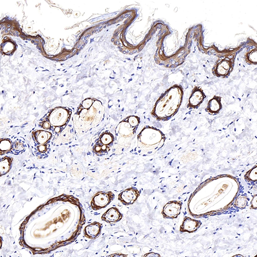 Immunohistochemistry analysis of paraffin-embedded rat skin  using CK-17 Polyclonal Antibody at dilution of 1:400.