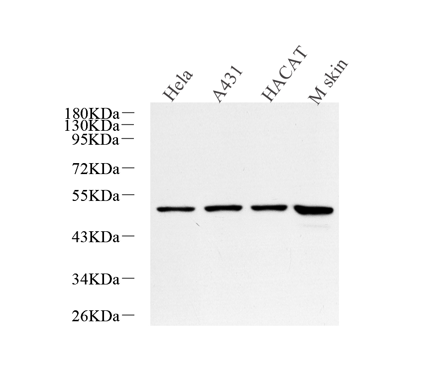 Western Blot analysis of various samples using CK-17 Polyclonal Antibody at dilution of 1:600.