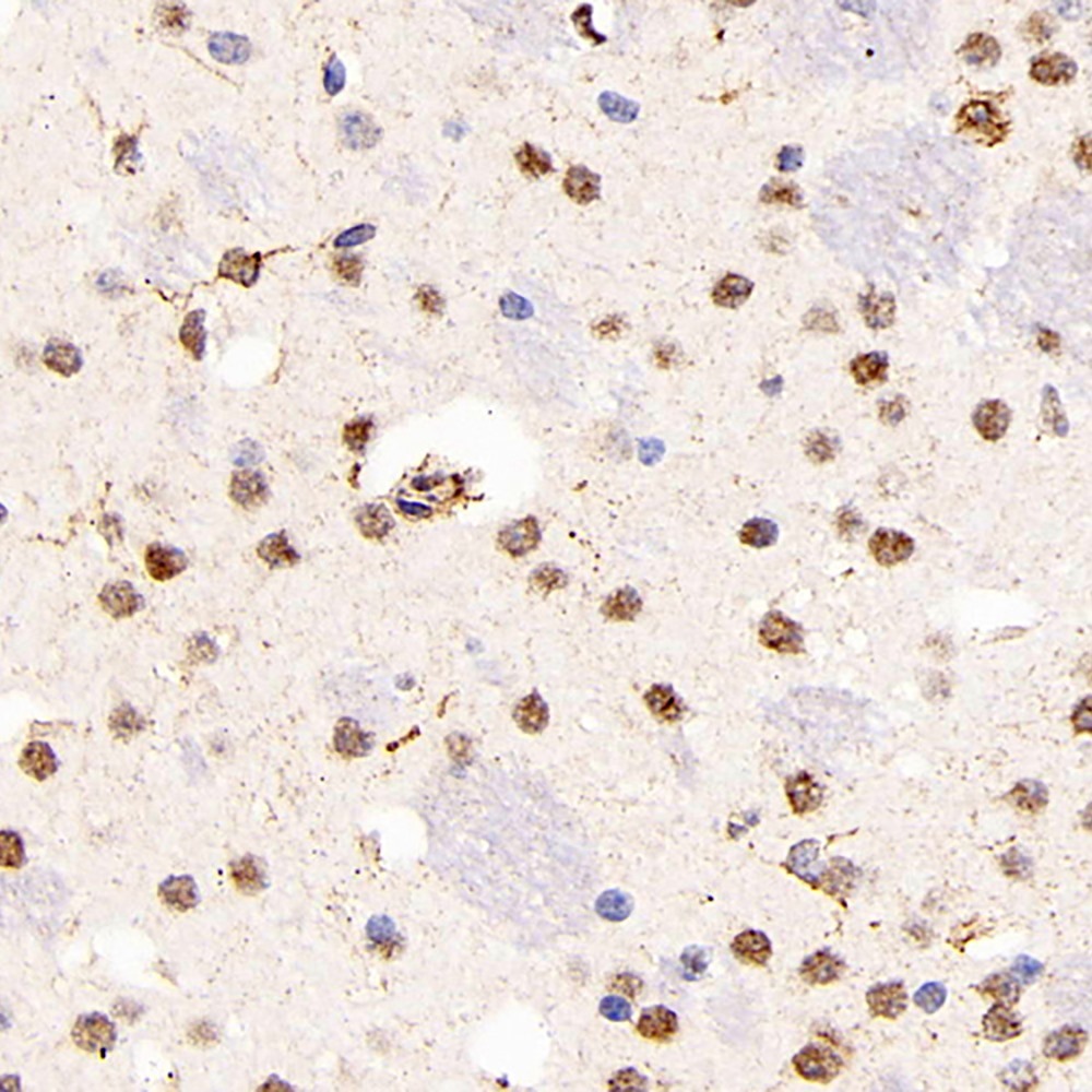 Immunohistochemistry analysis of paraffin-embedded mouse brain  using SOCS1 Polyclonal Antibody at dilution of 1:300.