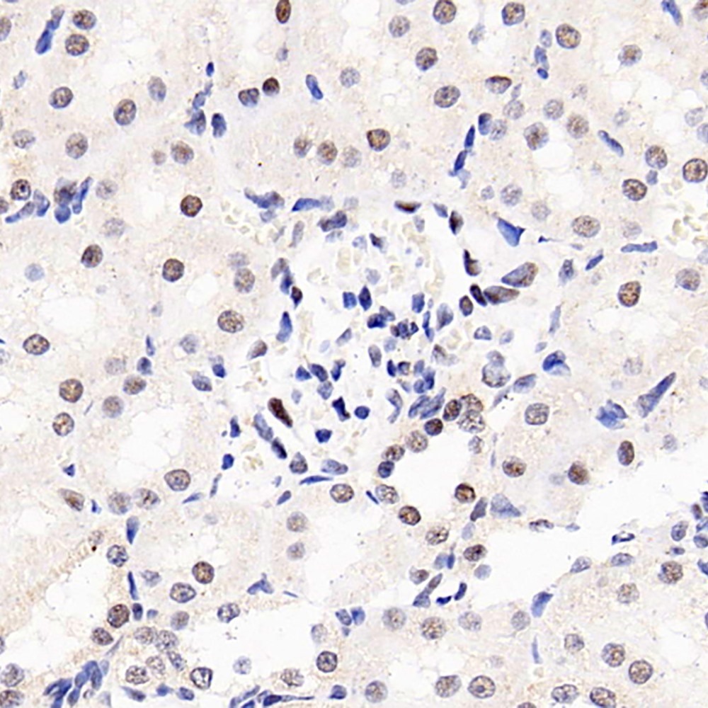 Immunohistochemistry analysis of paraffin-embedded rat kidney  using SOCS1 Polyclonal Antibody at dilution of 1:300.