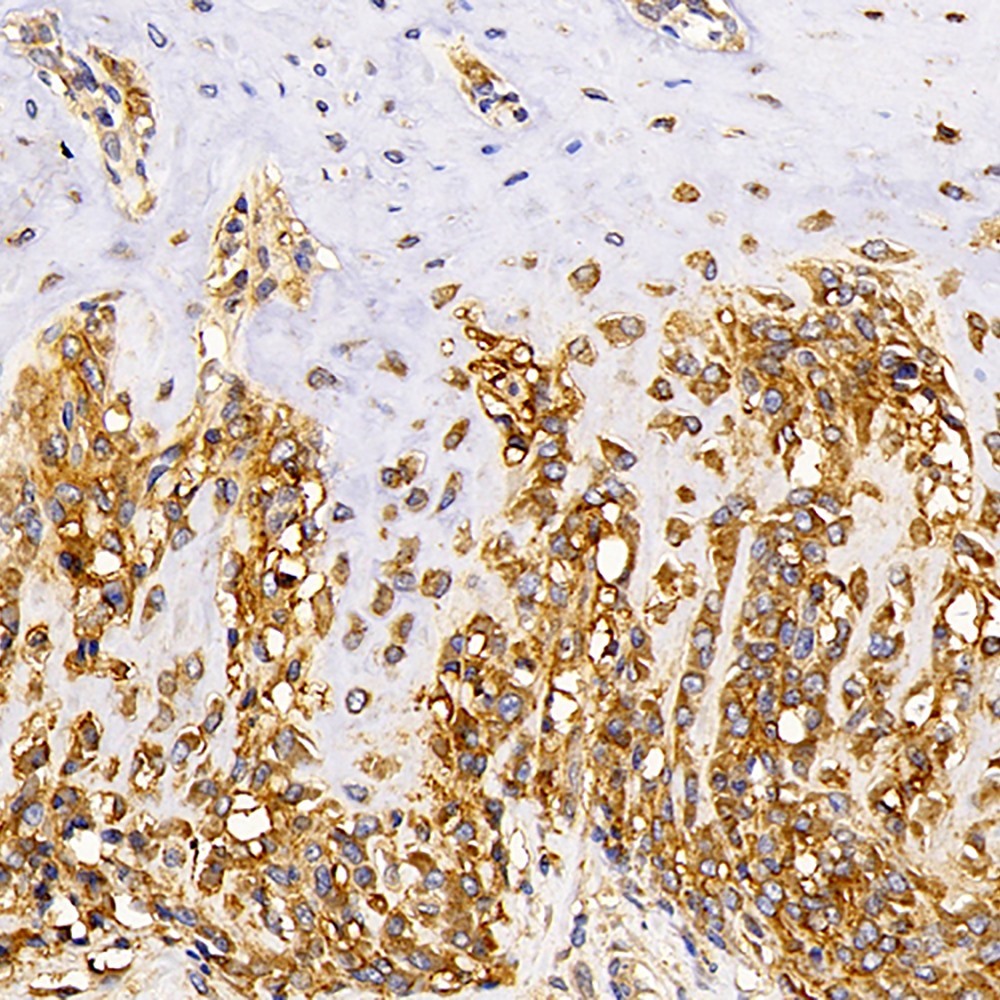 Immunohistochemistry analysis of paraffin-embedded rat bone  using MAGEC1 Polyclonal Antibody at dilution of 1:300.