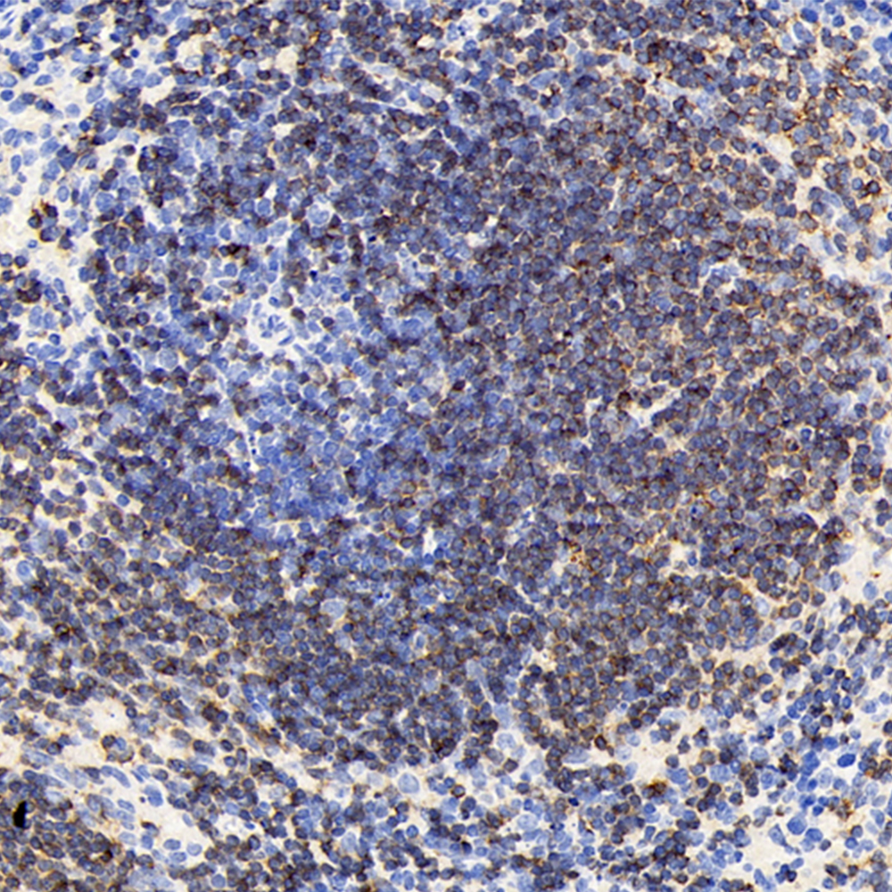 Immunohistochemistry analysis of paraffin-embedded mouse spleen  using CD19 Polyclonal Antibody at dilution of 1:200.