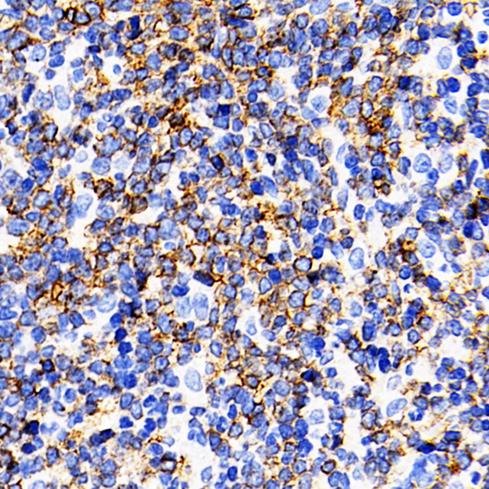 Immunohistochemistry analysis of paraffin-embedded Rat spleen  using CD19 Polyclonal Antibody at dilution of 1:200.