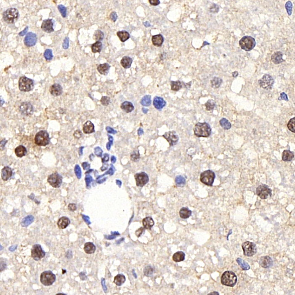 Immunohistochemistry analysis of paraffin-embedded rat liver  using PPARA Polyclonal Antibody at dilution of 1:300.