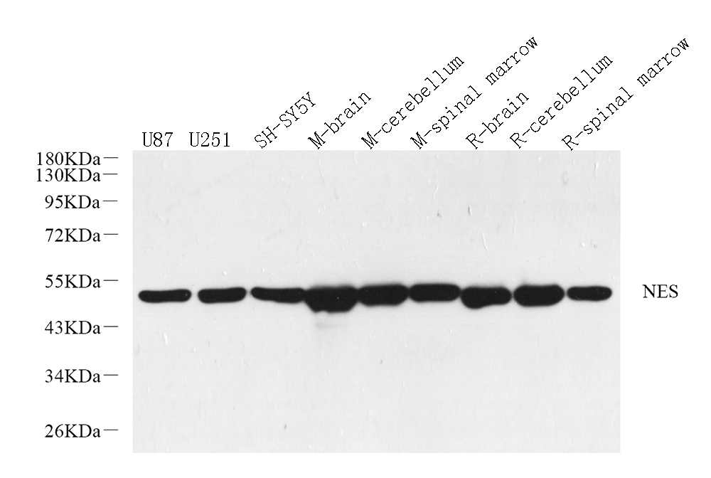 Western Blot analysis of various samples using ENO2 Polyclonal Antibody at dilution of 1:2000.
