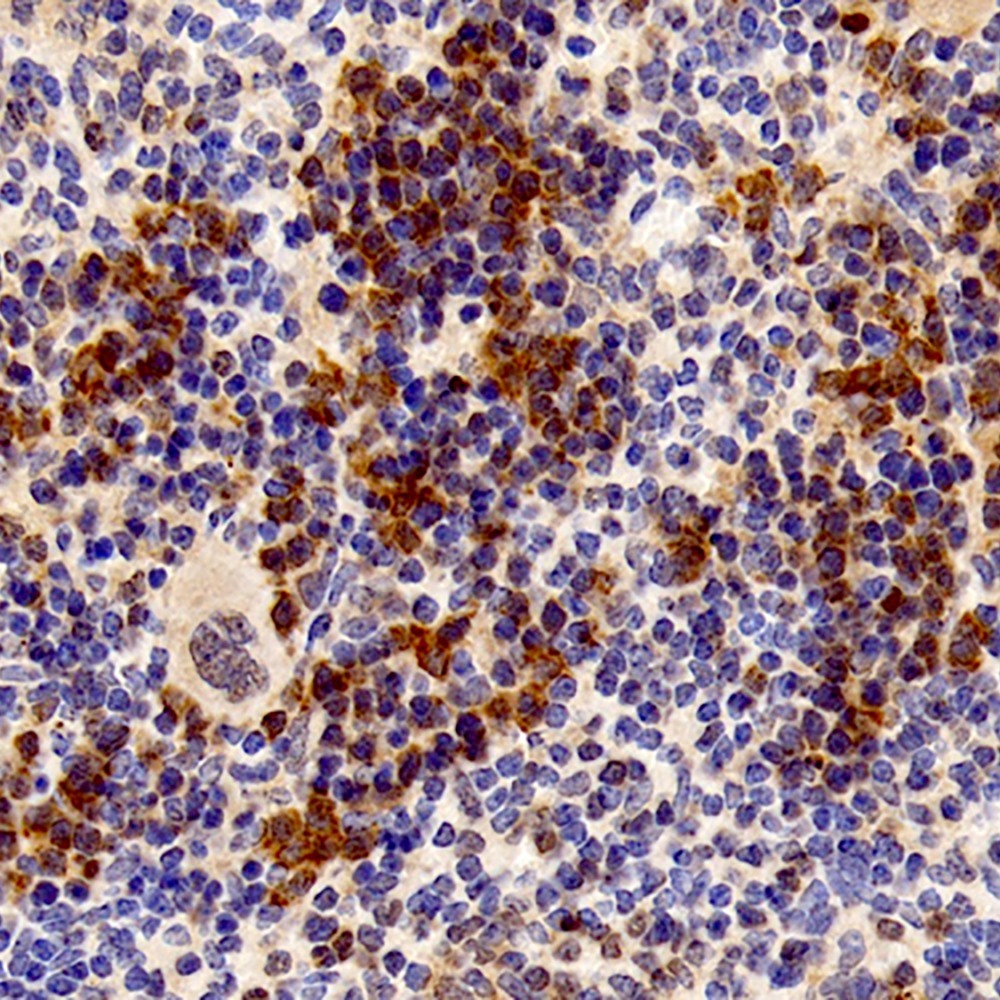 Immunohistochemistry analysis of paraffin-embedded mouse spleen  using UCP2 Polyclonal Antibody at dilution of 1:300.