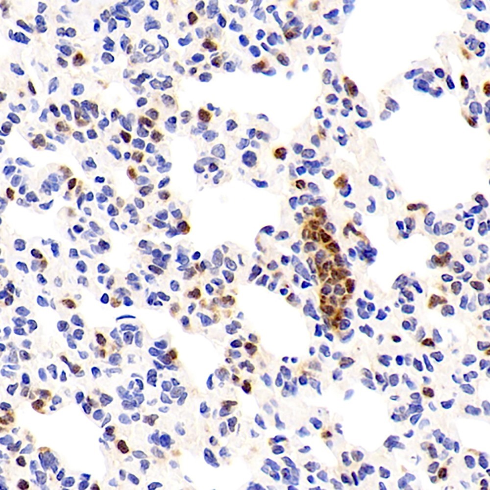 Immunohistochemistry analysis of paraffin-embedded rat lung  using UCP2 Polyclonal Antibody at dilution of 1:300.