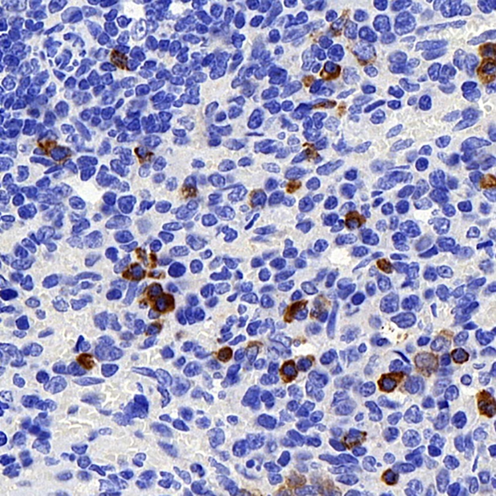 Immunohistochemistry analysis of paraffin-embedded rat spleen  using BAG2 Polyclonal Antibody at dilution of 1:400.