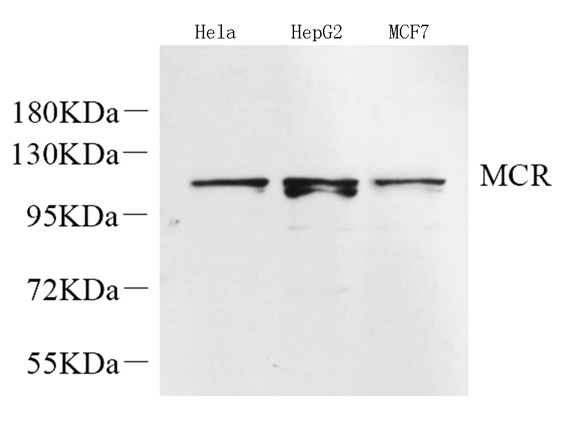 Western Blot analysis of various samples using Mineralocorticoid receptor Polyclonal Antibody at dilution of 1:600.