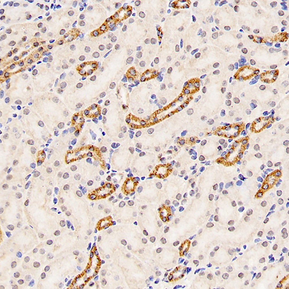 Immunohistochemistry analysis of paraffin-embedded mouse kidney  using Mineralocorticoid receptor Polyclonal Antibody at dilution of 1:300.