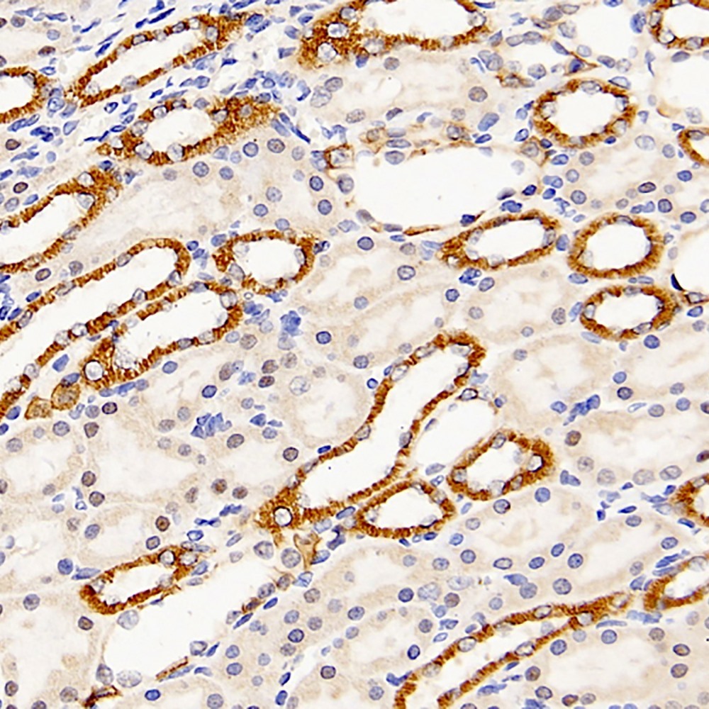 Immunohistochemistry analysis of paraffin-embedded rat kidney  using Mineralocorticoid receptor Polyclonal Antibody at dilution of 1:300.