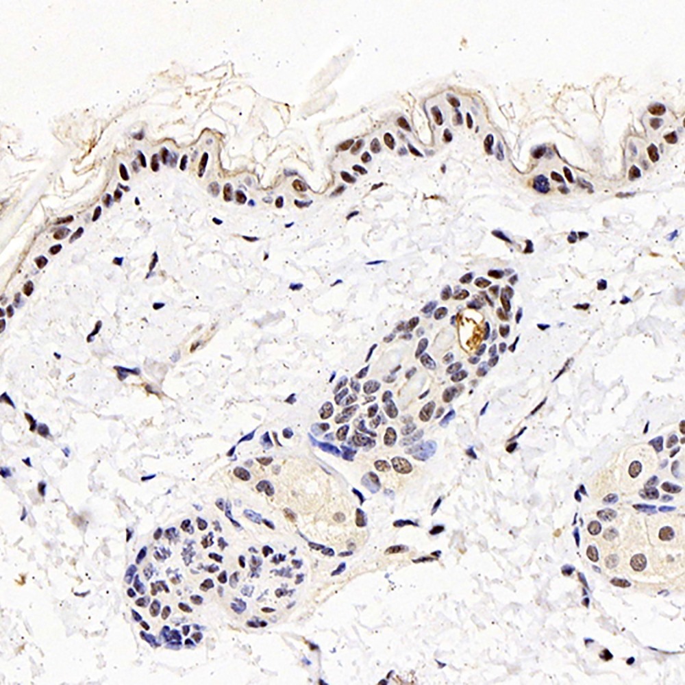 Immunohistochemistry analysis of paraffin-embedded mouse skin  using MGMT Polyclonal Antibody at dilution of 1:300.