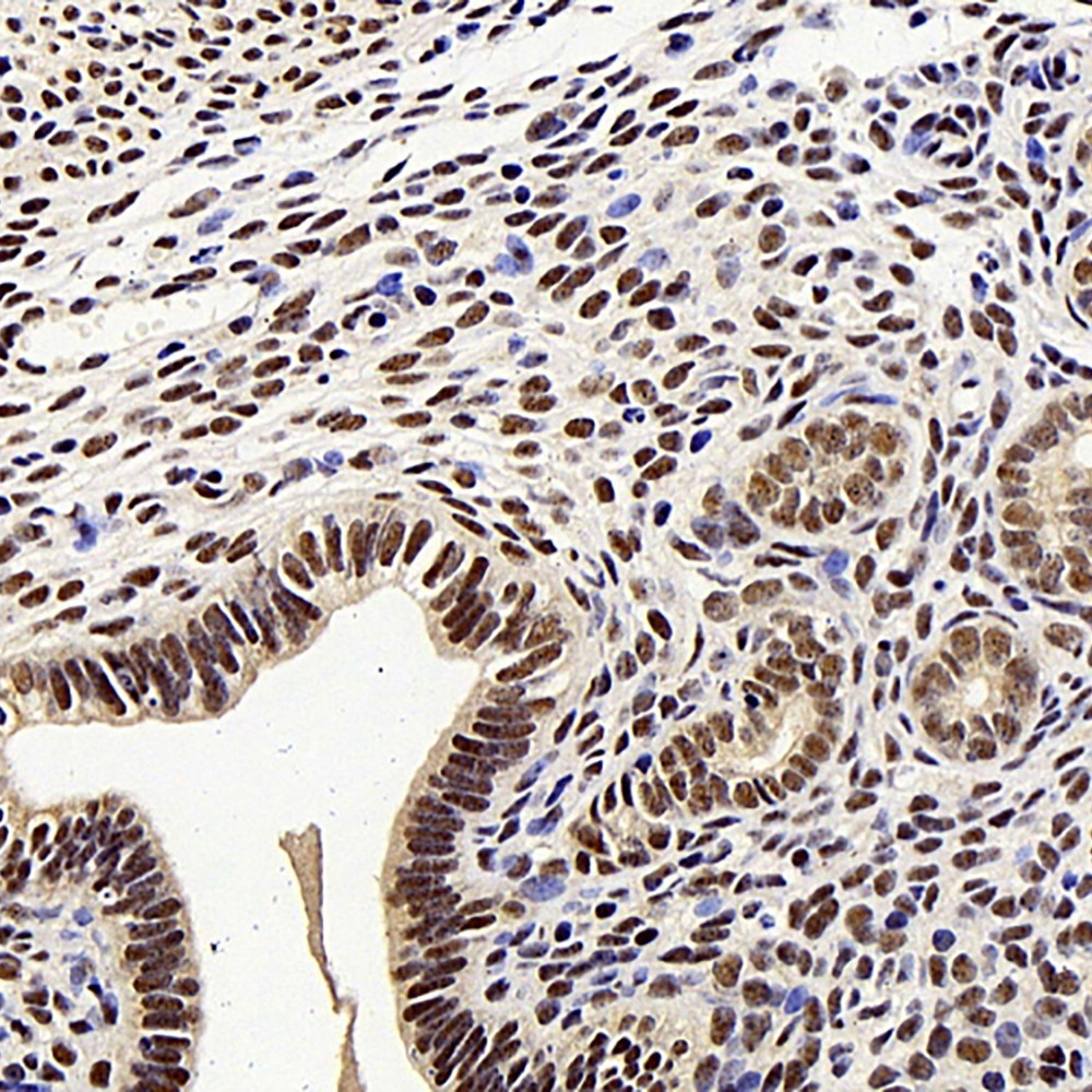 Immunohistochemistry analysis of paraffin-embedded mouse uters  using MGMT Polyclonal Antibody at dilution of 1:300.