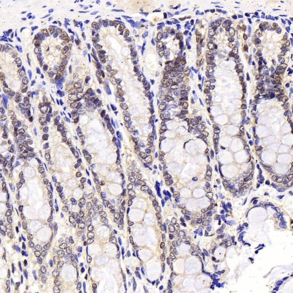 Immunohistochemistry analysis of paraffin-embedded rat stomach node  using MGMT Polyclonal Antibody at dilution of 1:300.