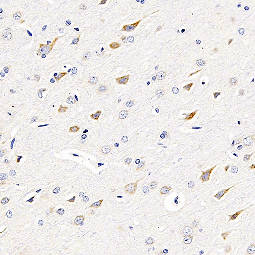 Immunohistochemistry analysis of paraffin-embedded rat brain  using GRIN2B Polyclonal Antibody at dilution of 1:200.