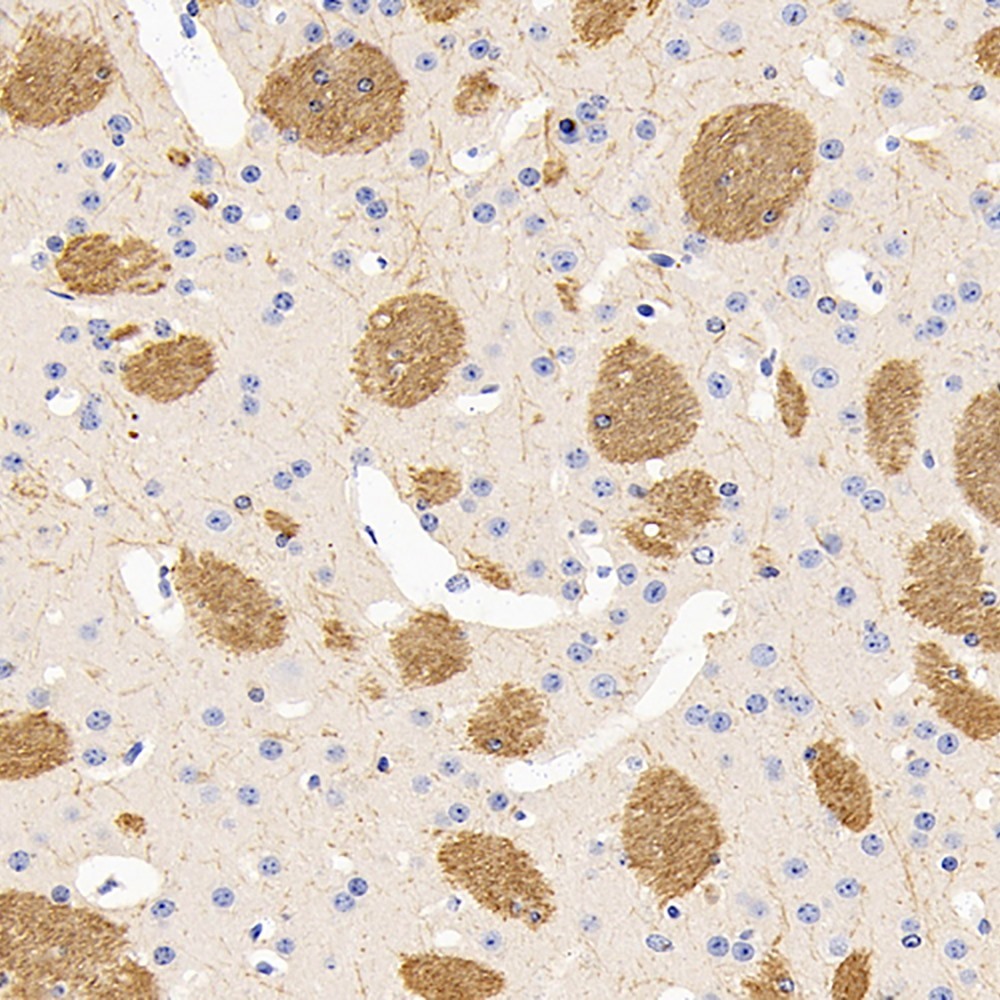 Immunohistochemistry analysis of paraffin-embedded mouse brain  using MBP Polyclonal Antibody at dilution of 1:600.