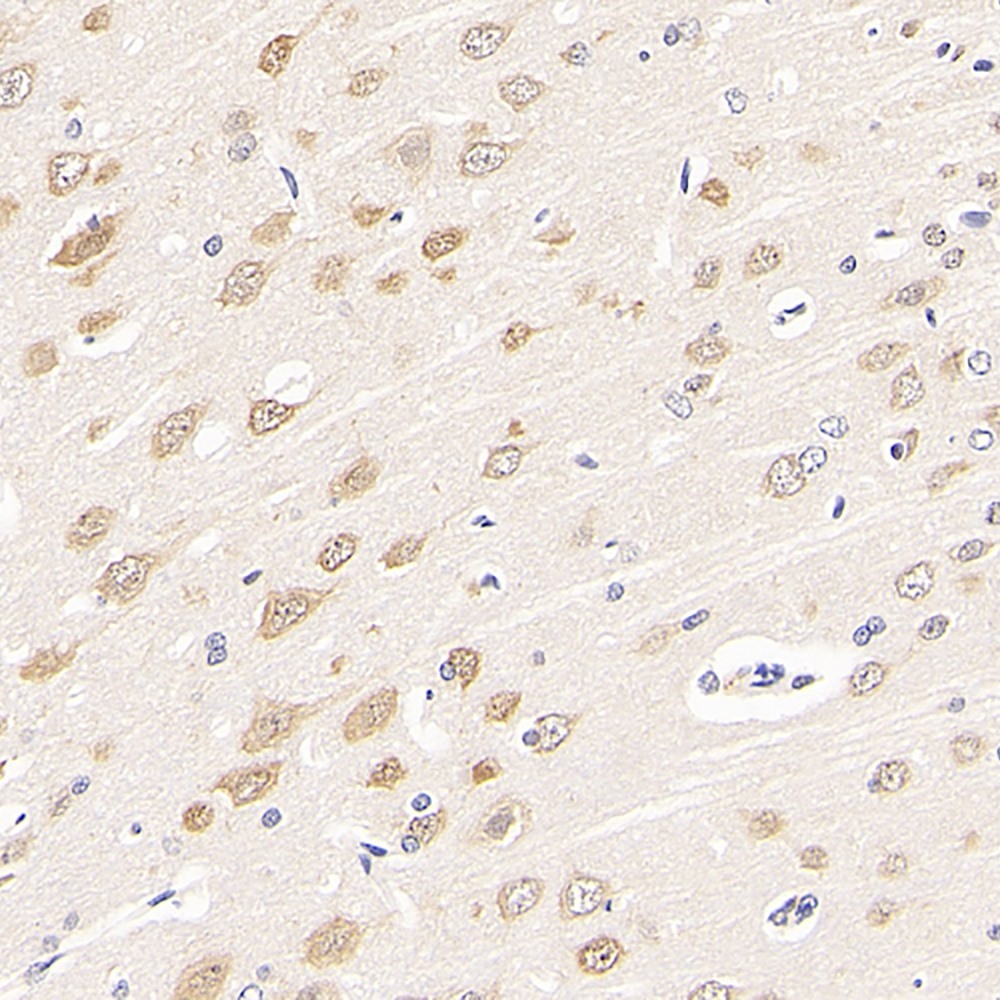 Immunohistochemistry analysis of paraffin-embedded rat brain  using RBFOX3 Polyclonal Antibody at dilution of 1:300.