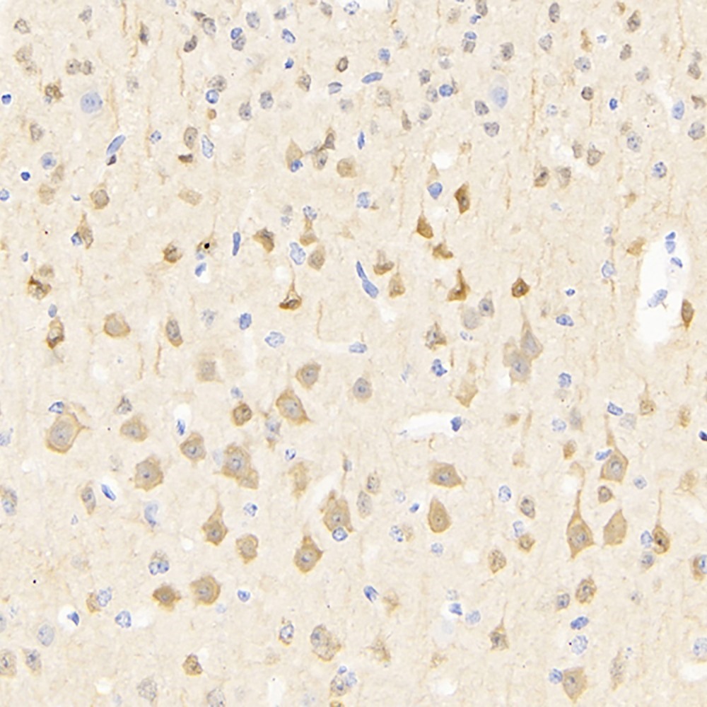 Immunohistochemistry analysis of paraffin-embedded mouse brain  using PGP 9.5 Polyclonal Antibody at dilution of 1:500.