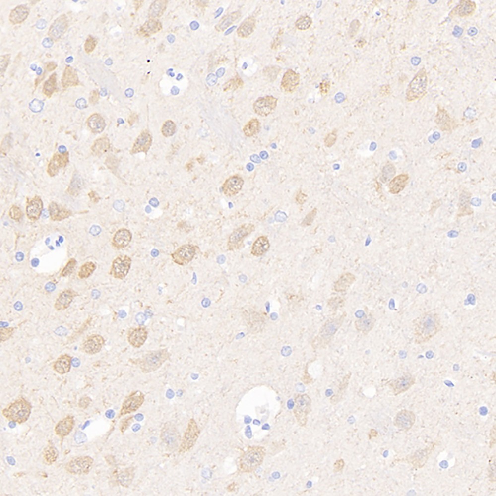 Immunohistochemistry analysis of paraffin-embedded rat brain  using PGP 9.5 Polyclonal Antibody at dilution of 1:500.