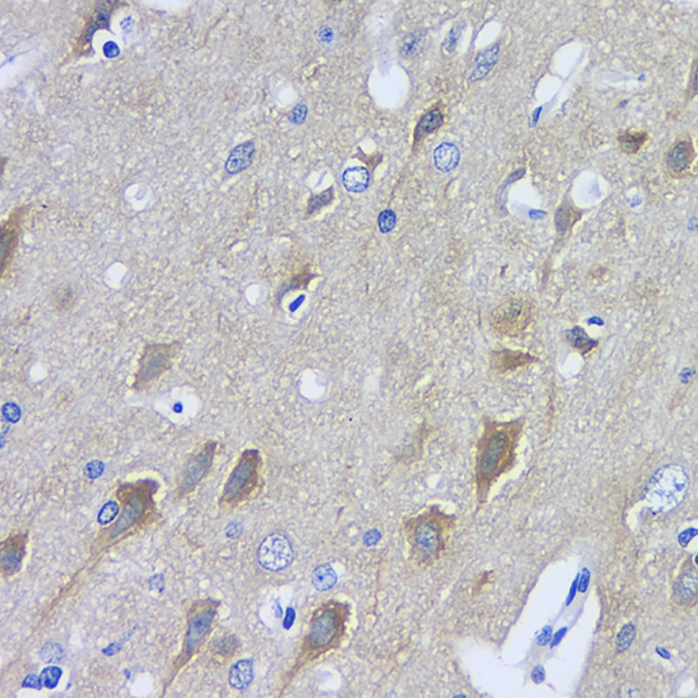Immunohistochemistry analysis of paraffin-embedded rat brain  using ENO2 Polyclonal Antibody at dilution of 1:400.